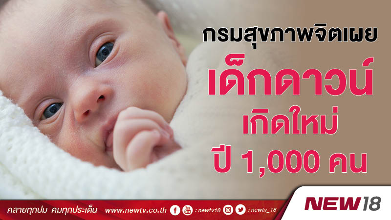 กรมสุขภาพจิตเผยเด็กดาวน์เกิดใหม่ปี 1,000 คน 