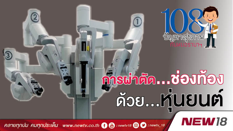 108 ปัญหากับหมอรามาฯ : การผ่าตัดช่องท้องด้วยหุ่นยนต์ (Robotic Assisted Surgery) 