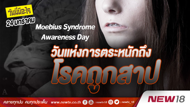 วันนี้มีอะไร: 24 มกราคม  วันแห่งการตระหนักถึงโรคถูกสาป (Moebius Syndrome Awareness Day)