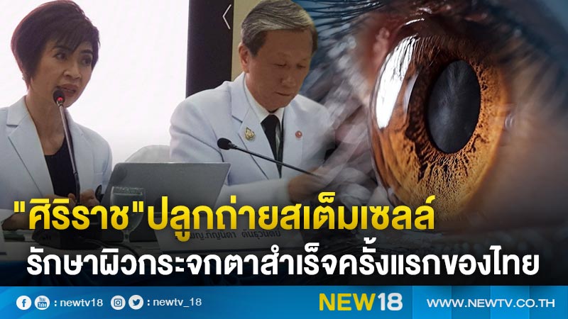 "ศิริราช"ปลูกถ่ายสเต็มเซลล์รักษาผิวกระจกตาสำเร็จครั้งแรกของไทย
