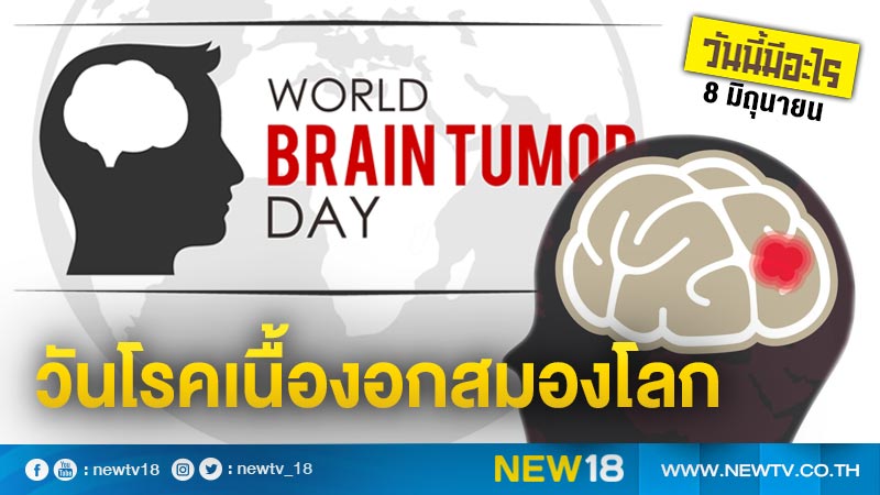 วันนี้มีอะไร: 8 มิถุนายน วันโรคเนื้องอกสมองโลก (World Brain Tumor Day)