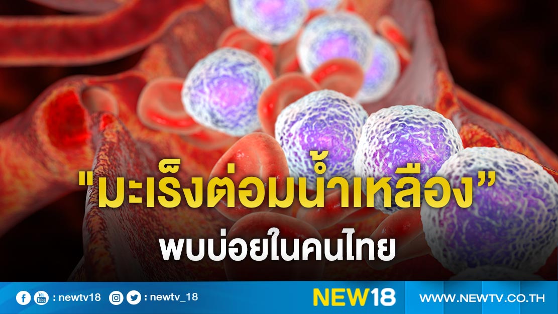 "มะเร็งต่อมน้ำเหลือง” พบบ่อยในคนไทย 