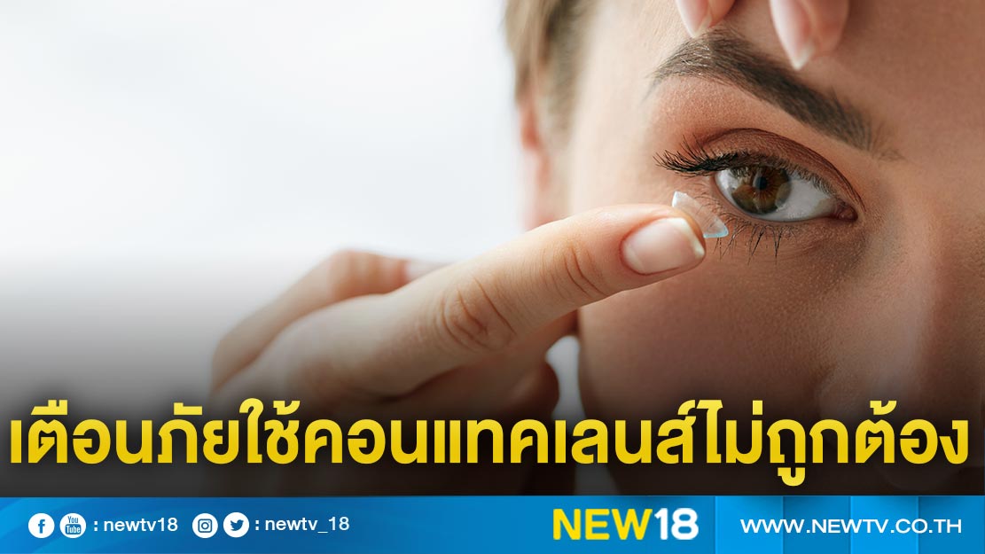 แพทย์เตือนภัยใช้คอนแทคเลนส์ไม่ถูกต้องเสี่ยงตาบอด